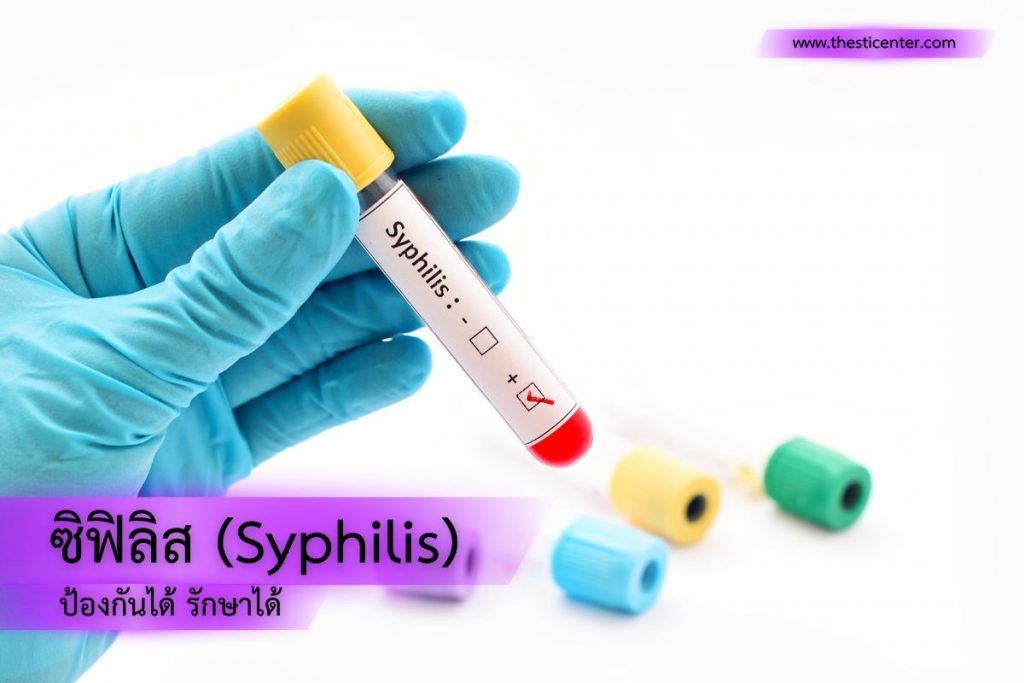 ซิฟิลิส (Syphilis) ป้องกันได้ รักษาได้