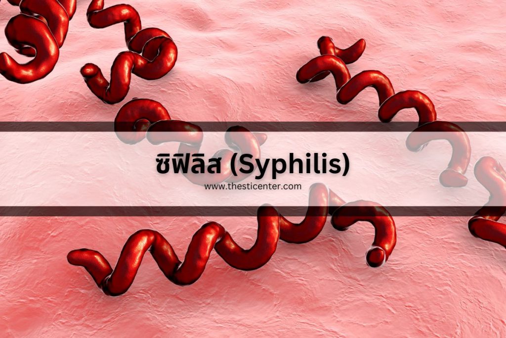 ซิฟิลิส (Syphilis)