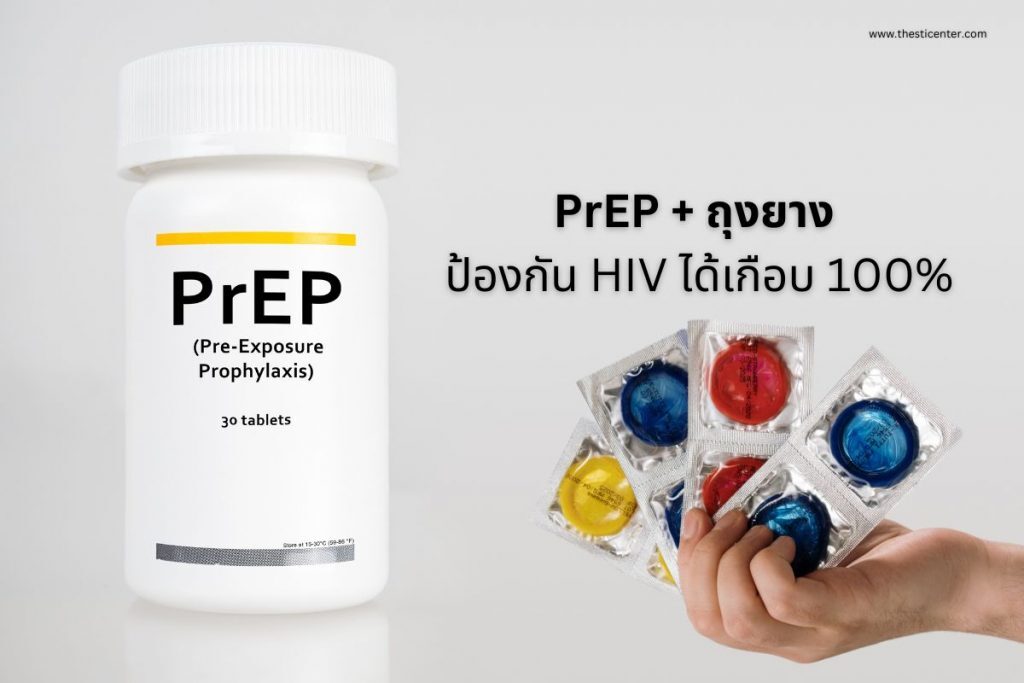 PrEP กับ ถุงยาง ป้องกัน HIV ได้เกือบ 100%