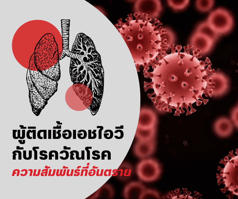 HIV และวัณโรค: การตรวจและการดูแลร่วมกัน
