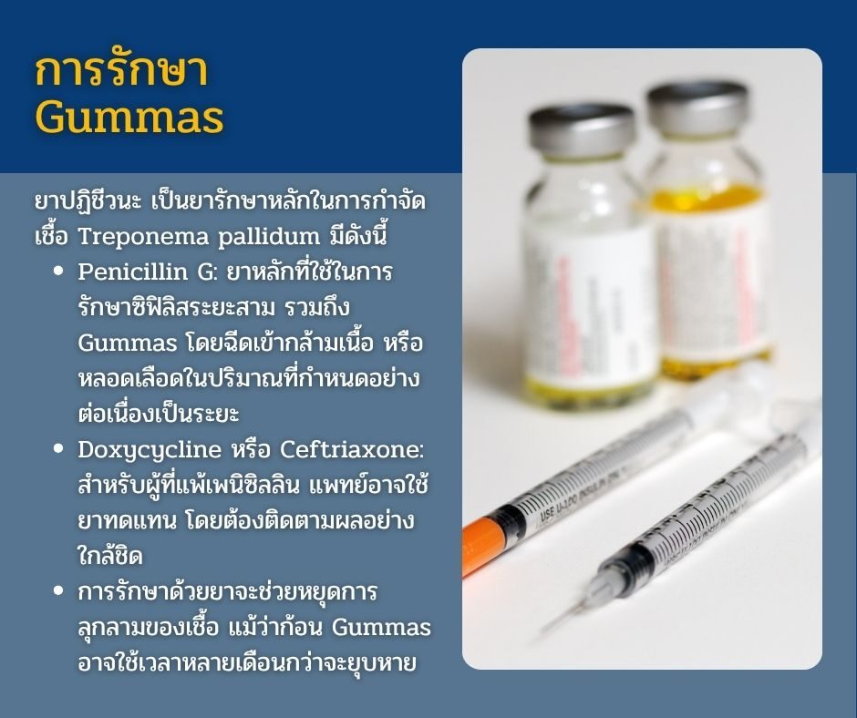 การรักษา Gummas