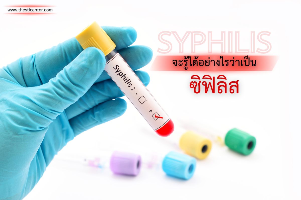 จะรู้ได้อย่างไรว่าเป็นซิฟิลิส ?