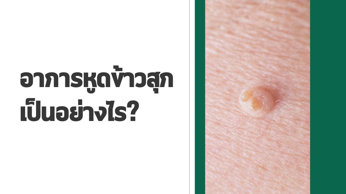 อาการหูดข้าวสุก เป็นอย่างไร