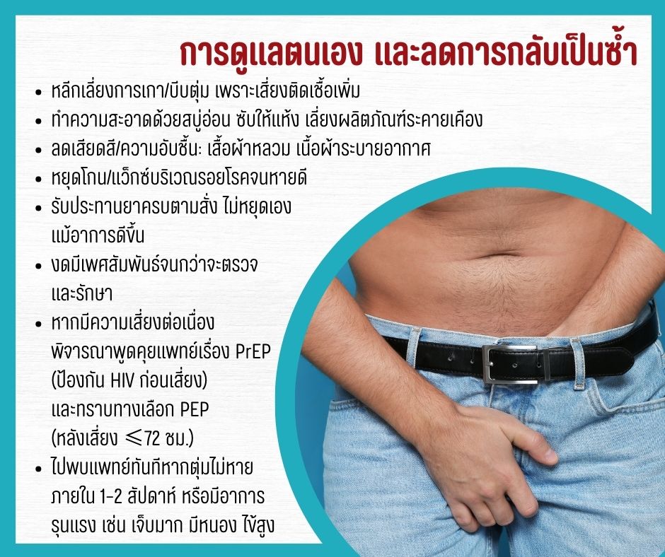 การดูแลตนเอง และลดการกลับเป็นซ้ำ