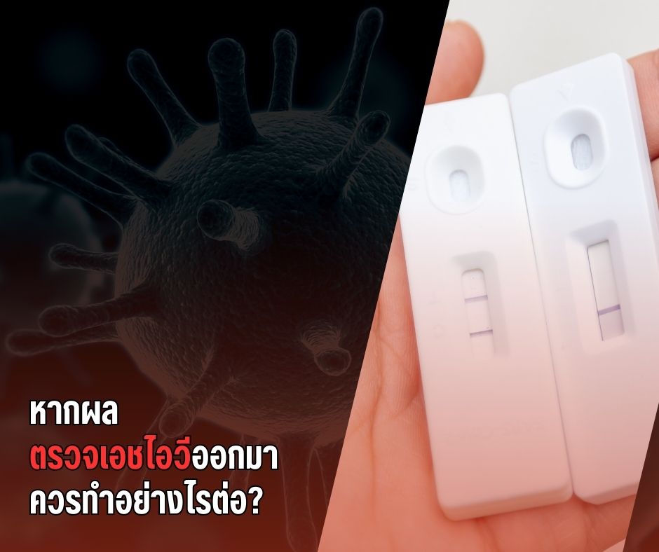 หากผลตรวจเอชไอวีออกมา ควรทำอย่างไรต่อ