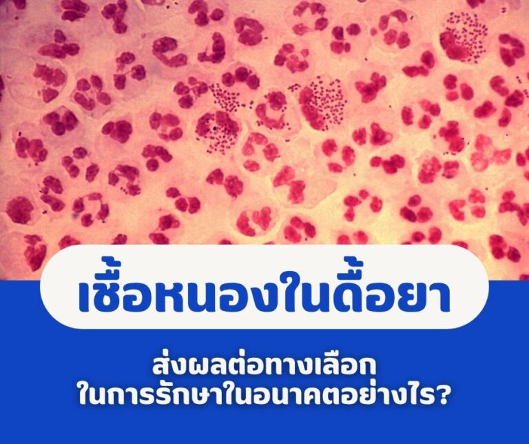 เชื้อหนองในดื้อยาส่งผลต่อทางเลือกในการรักษาในอนาคตอย่างไร?